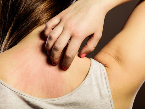 woman scratching her back closeup